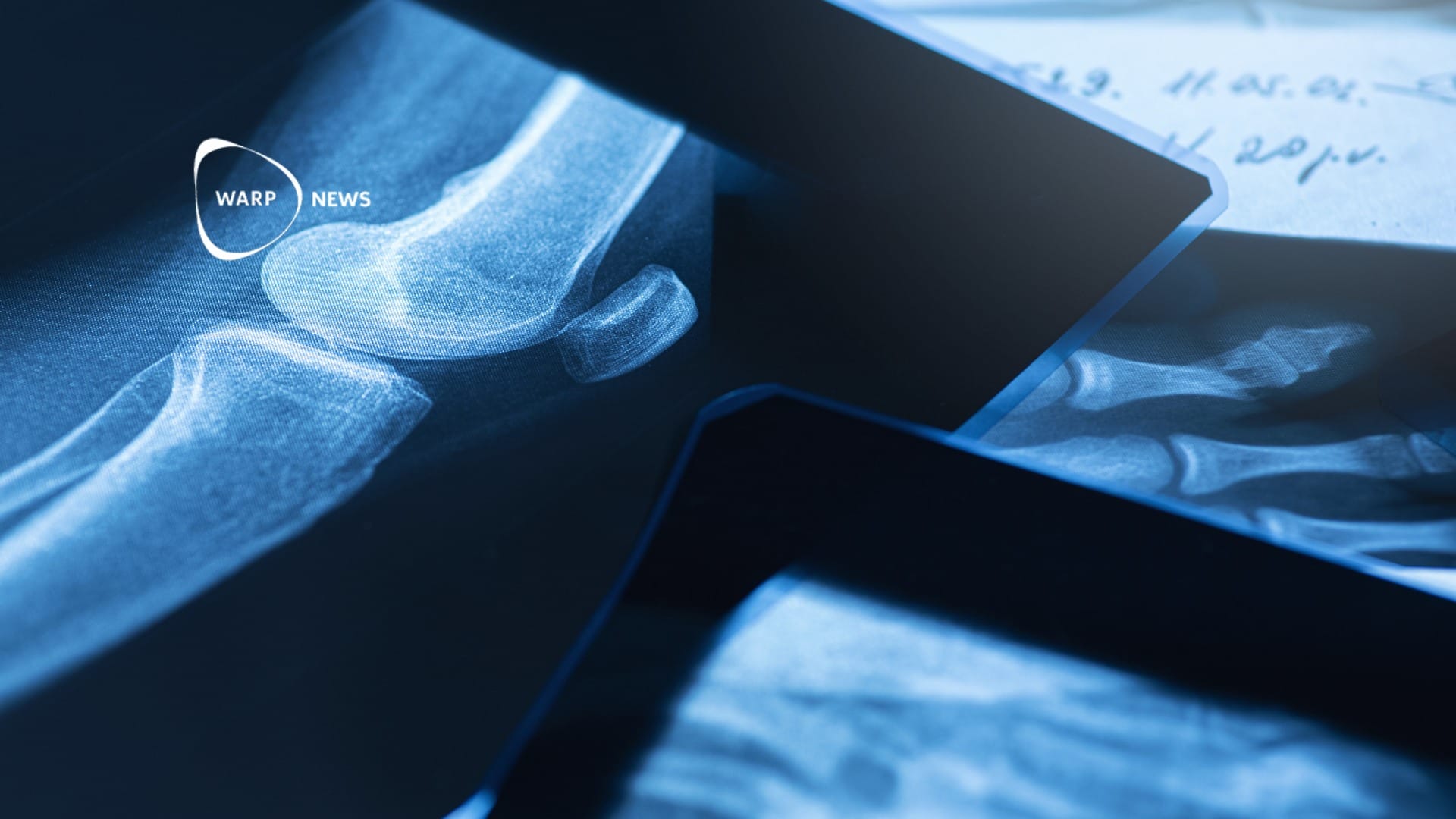🦴 Faster healing of bone fractures – making them three times stronger